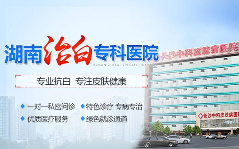 长沙白癜风医院