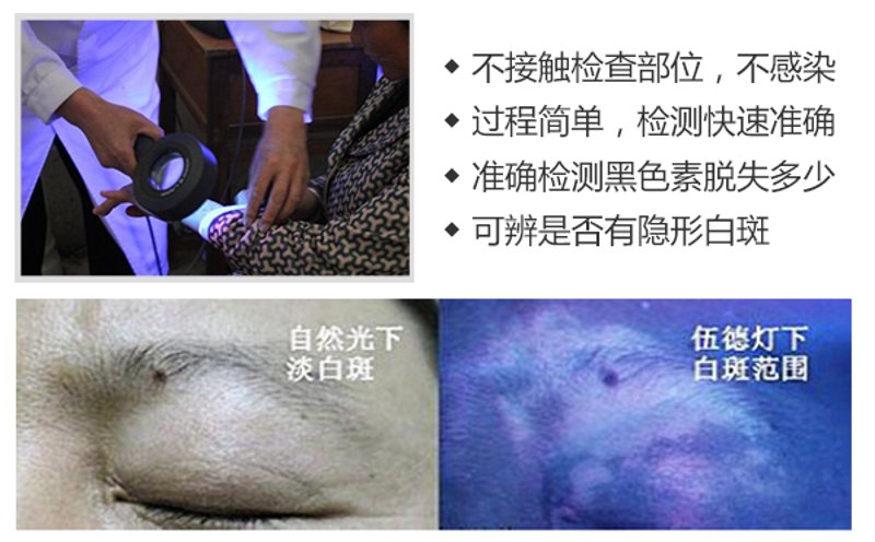 如何选择专业的白癜风专科医院？一份详尽的选购指南