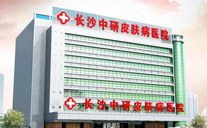 长沙中研白癜风医院